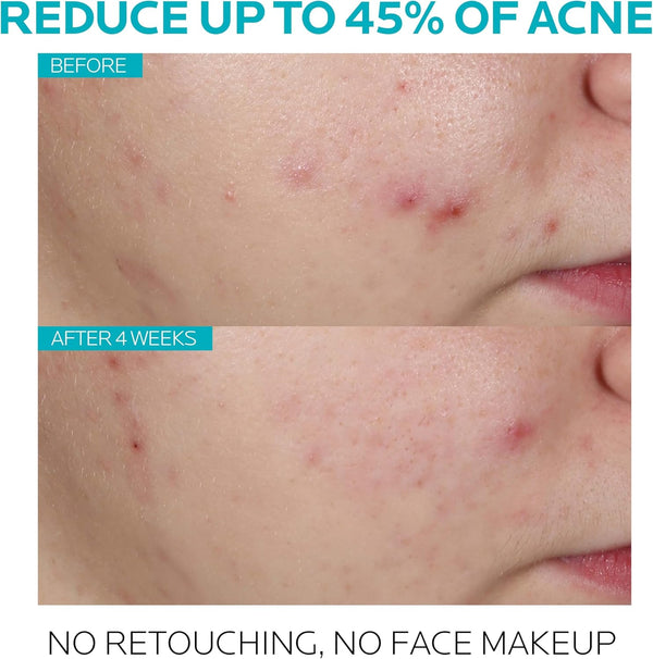 La Roche Posay Effaclar Serum