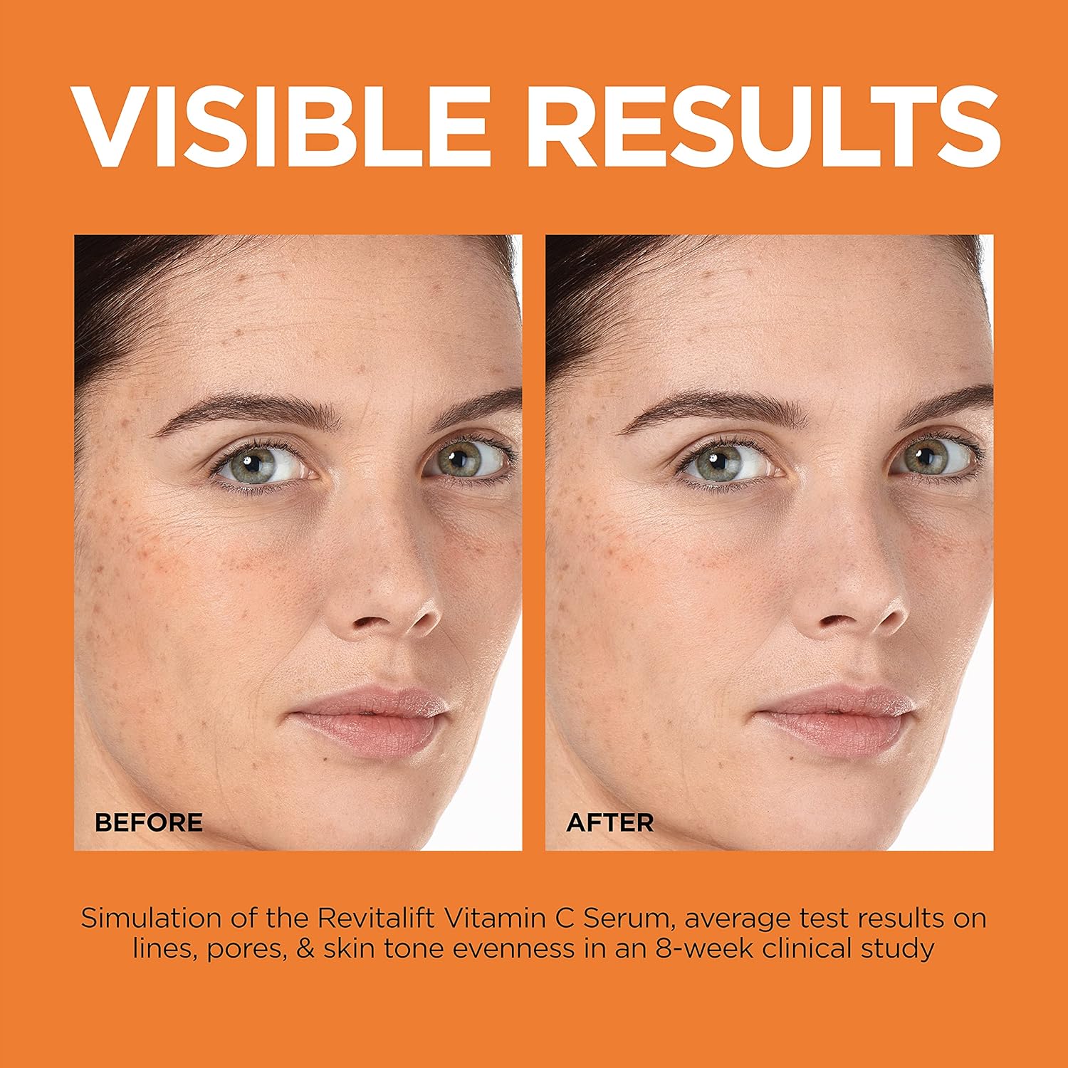 L'Oreal Revitalift 12% Pure Vitamin C Serum, Vitamin E, Salicylic Acid